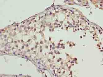Polyclonal Rabbit anti-Human CYB5R2 Antibody (IHC, WB)