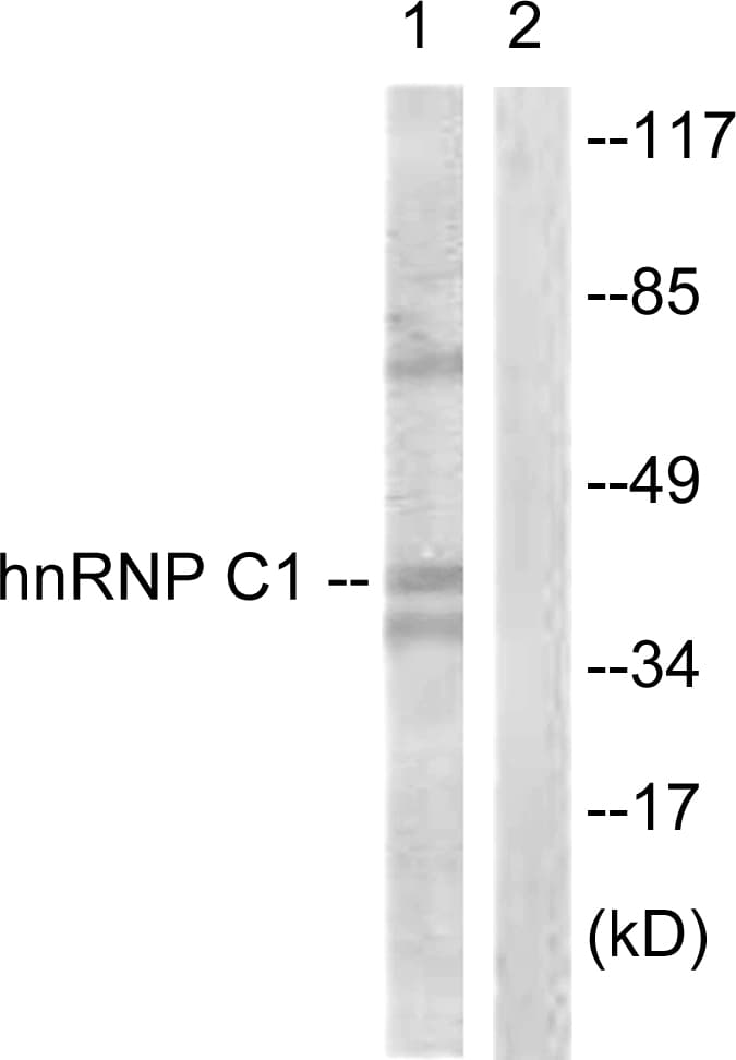 IHC-plus™ Polyclonal Rabbit anti-Human HNRNPC / HNRNP C Antibody (aa231-280, IHC, WB)