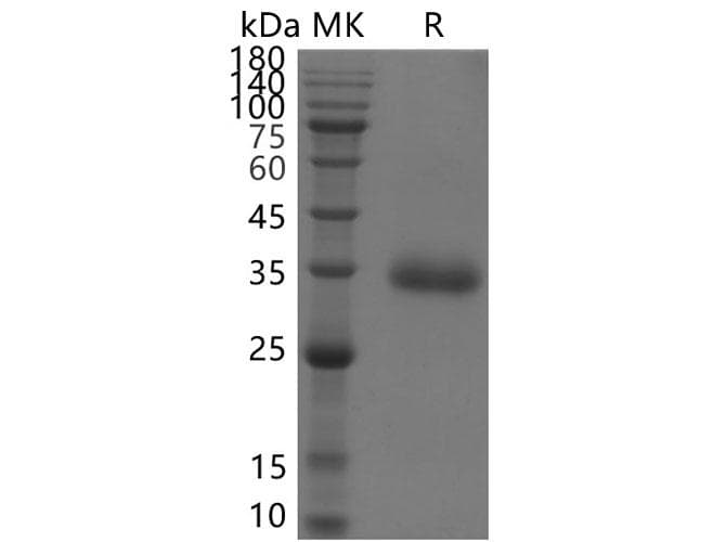 Coronavirus SARS-CoV-2 SARS-CoV-2 Spike Glycoprotein (Recombinant His,C-terminus)