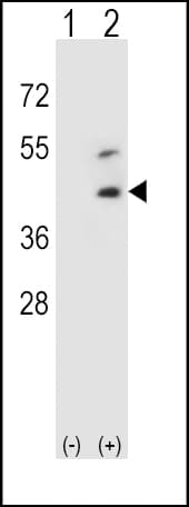 Polyclonal Rabbit anti-Human DCN / Decorin Antibody (aa122-150, IHC, WB)