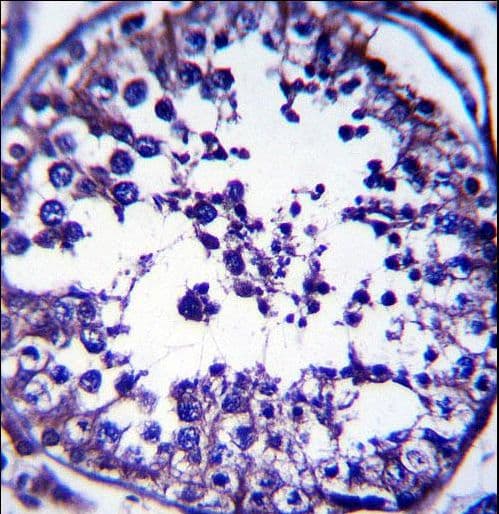 RAB5C Antibody (aa178-207)