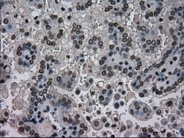NRBP1 / NRBP Antibody (clone OTI4C1)