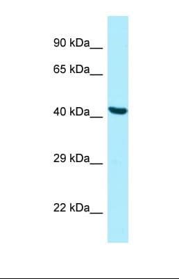 PANK2 Antibody (aa308-357)