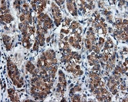 PSMC3 Antibody (clone OTI9C11)