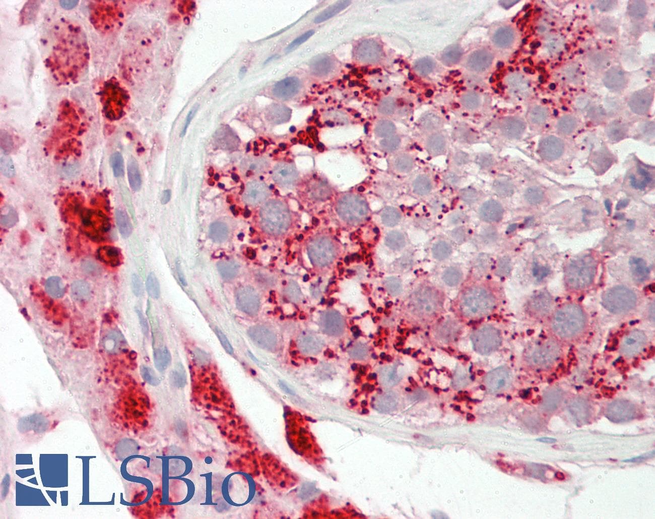 PathPlus™ Polyclonal Rabbit anti-Mouse CTSD / Cathepsin D Antibody (C-Terminus, IHC, WB)