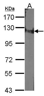 Polyclonal Rabbit anti-Human DDB1 Antibody (aa749-1140, IHC, WB)