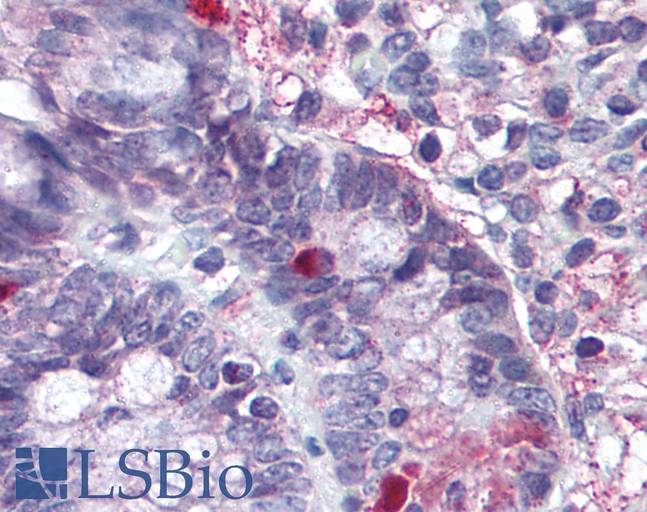 PathPlus™ Polyclonal Rabbit anti-Human GPR49 / LGR5 Antibody (Cytoplasmic Domain, IHC, IF)
