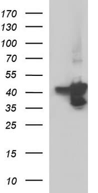 SERPINB3 Antibody (clone OTI1C12)