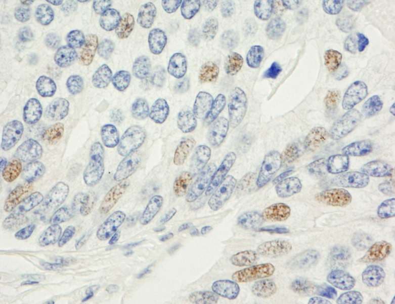 MAD1L1 / MAD1 Antibody (aa1-50)