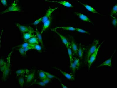 WAS / WASP Antibody