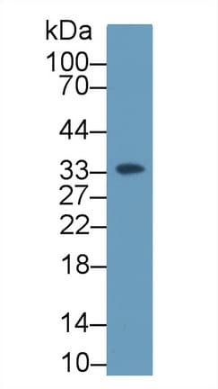 GC1qR / C1QBP Antibody (aa72-279)