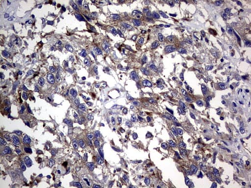 CEACAM5 / CD66e Antibody (aa35-680, clone OTI1C2)