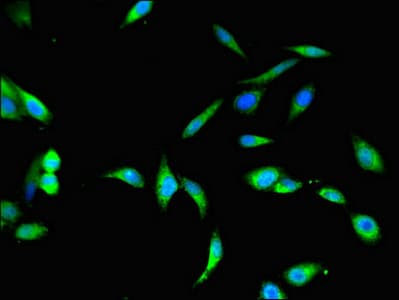 BHMT2 Antibody
