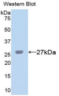 CHI3L1 / YKL-40 Antibody (aa112-377, FITC)