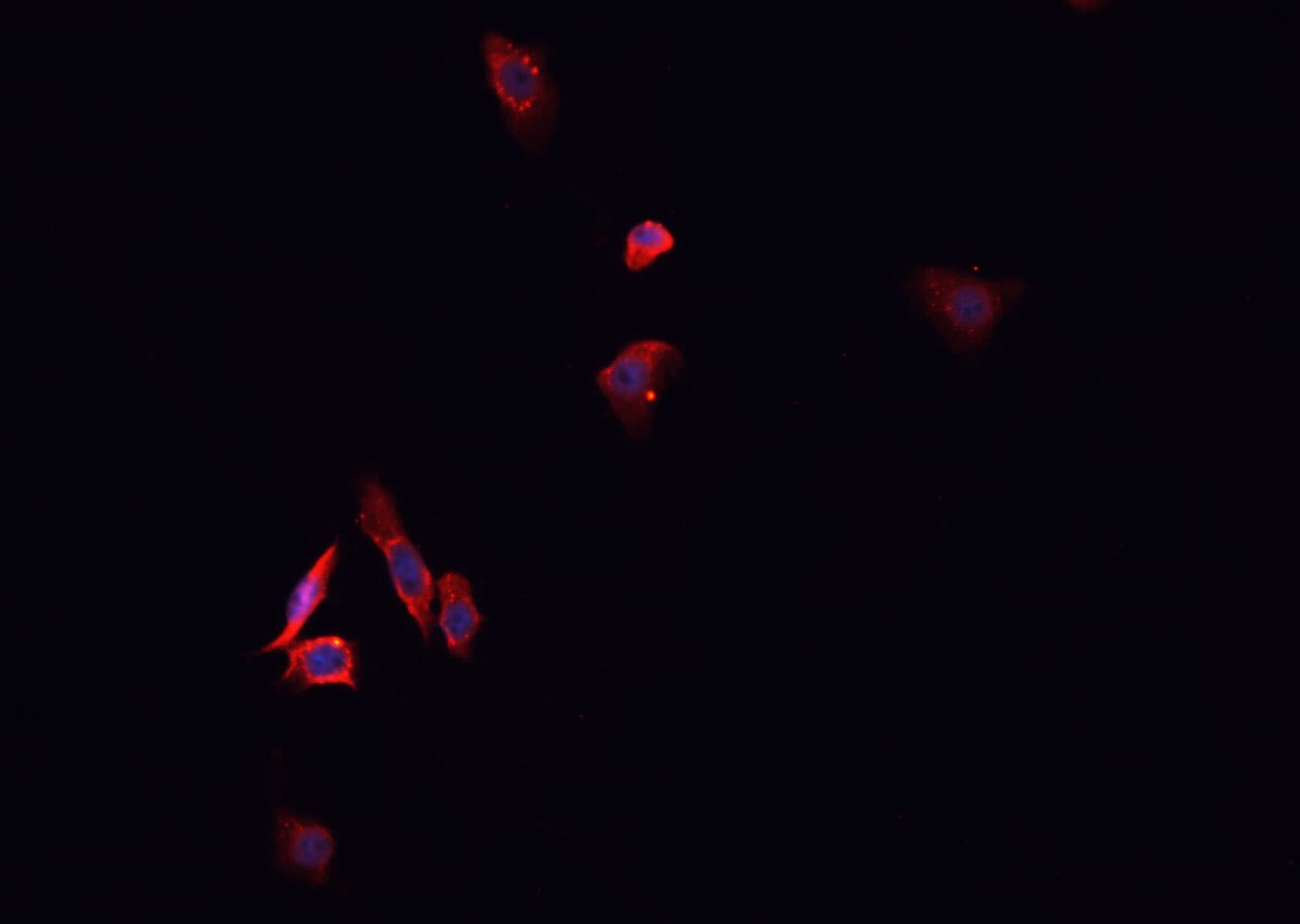 DHFR Antibody