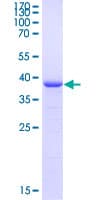 Human FOXO1 / FKHR Protein (Recombinant GST, N-terminus)