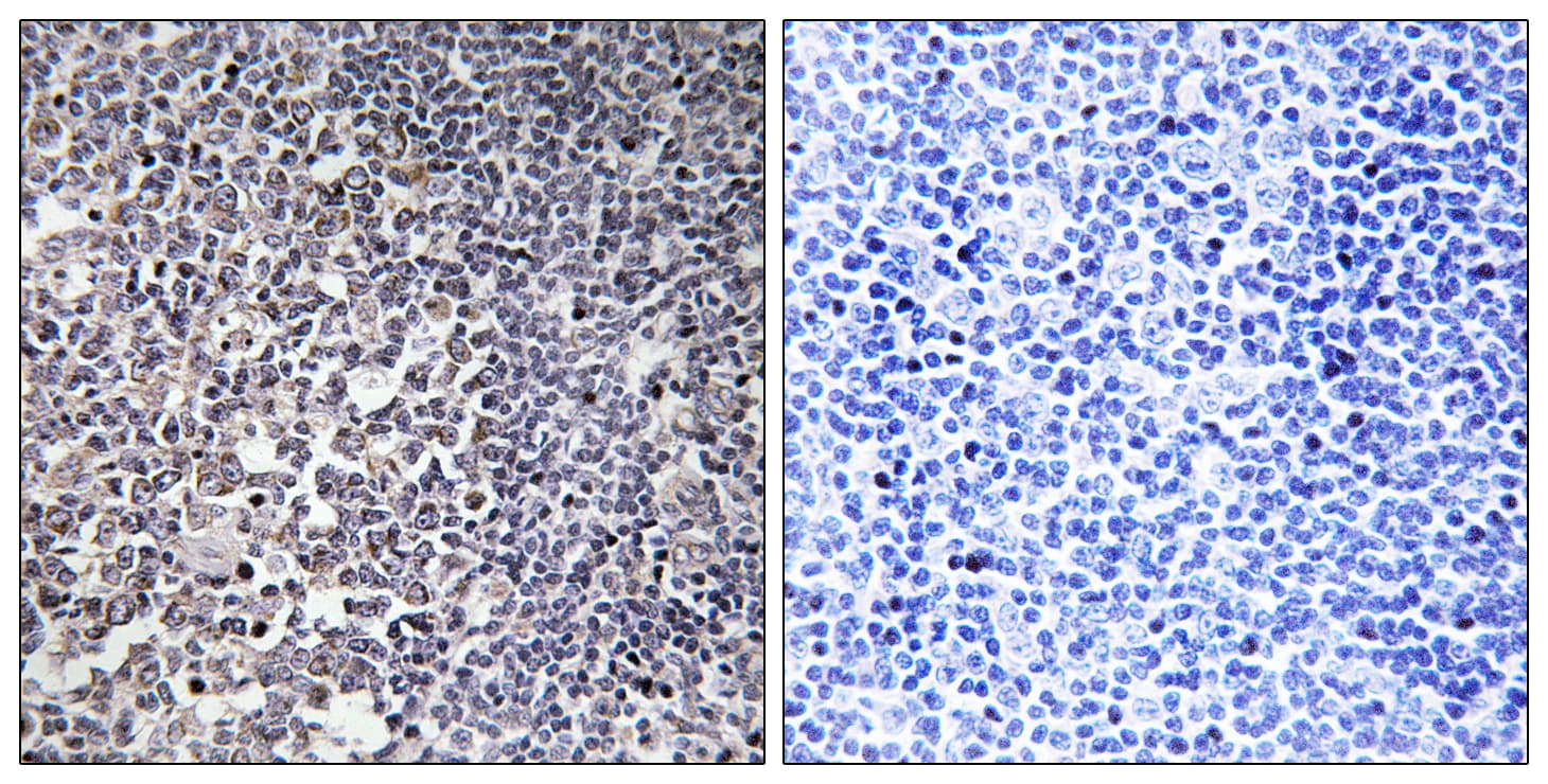Polyclonal Rabbit anti-Human MRPS16 Antibody (aa81-130, IHC, WB)