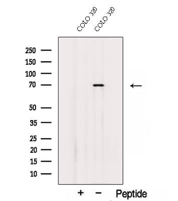 SDR / SDPR Antibody