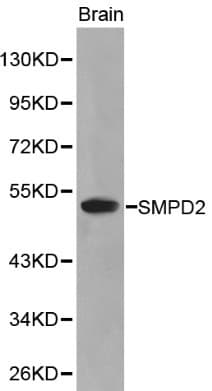 SMPD2 Antibody