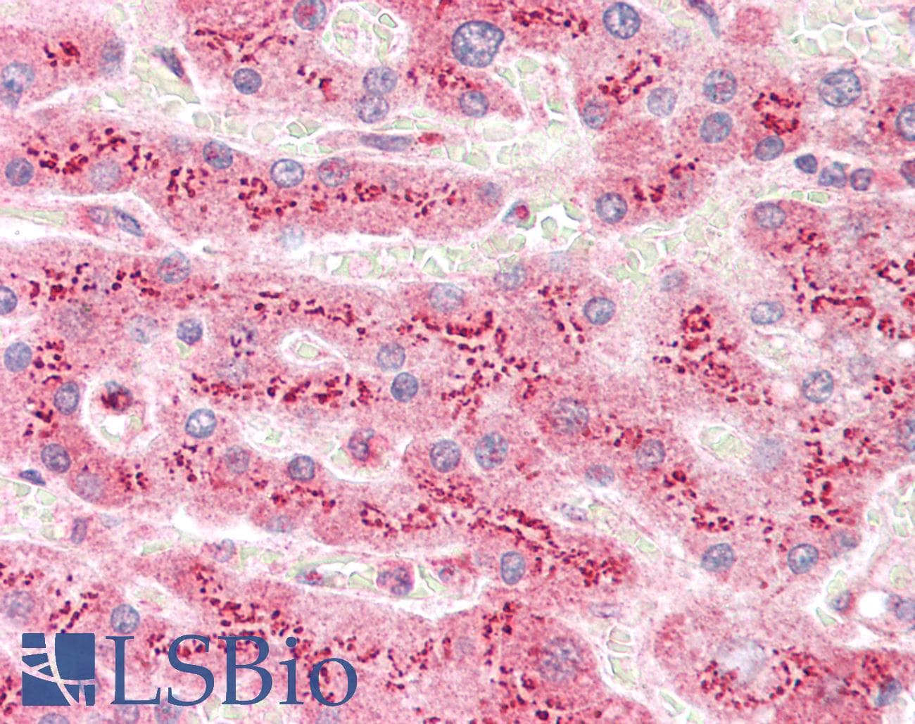 IHC-plus™ MAN2A1 / Mannosidase II Antibody (aa865-1144)