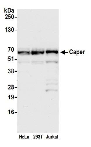 RBM39 Antibody (aa325-375)