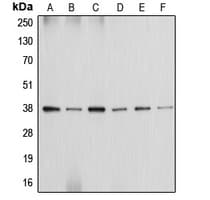 ANXA2 / Annexin A2 Antibody (Internal)