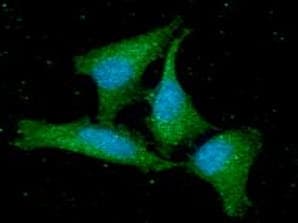 GMF Beta / GMFB Antibody (clone AT44D8)