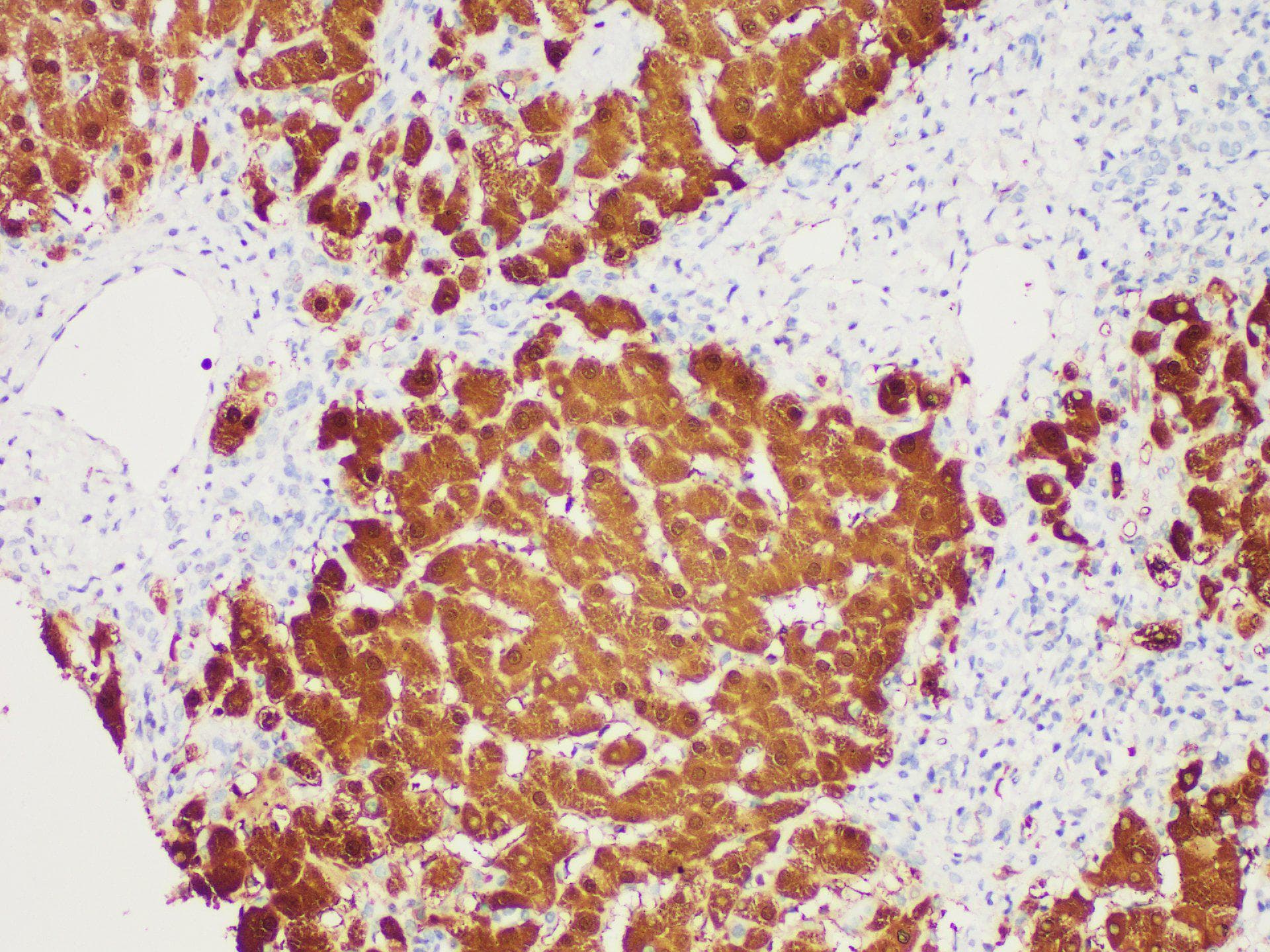 ARG1 / Arginase 1 Antibody