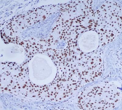 PRKDC / DNA-PKcs Antibody