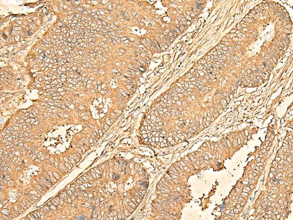 RPS28 / Ribosomal Protein S28 Antibody