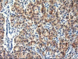 TBC1D21 Antibody (clone OTI1A8)