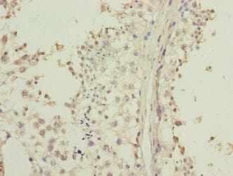 LRRC20 Antibody