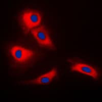 Polyclonal Rabbit anti-Human TRAF3 Antibody (Internal, IF, WB)