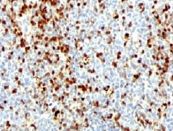 ZAP70 Antibody (clone ZTP70-1, Ready-to-Use)