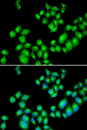 IHC-plus™ DRD3 / Dopamine Receptor D3 Antibody