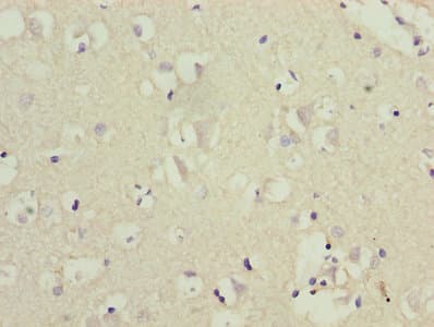 Polyclonal Rabbit anti-Human CRFR1 / CRHR1 Antibody (WB)