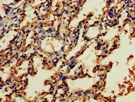 Polyclonal Rabbit anti-Human NOG / Noggin Antibody (IHC)
