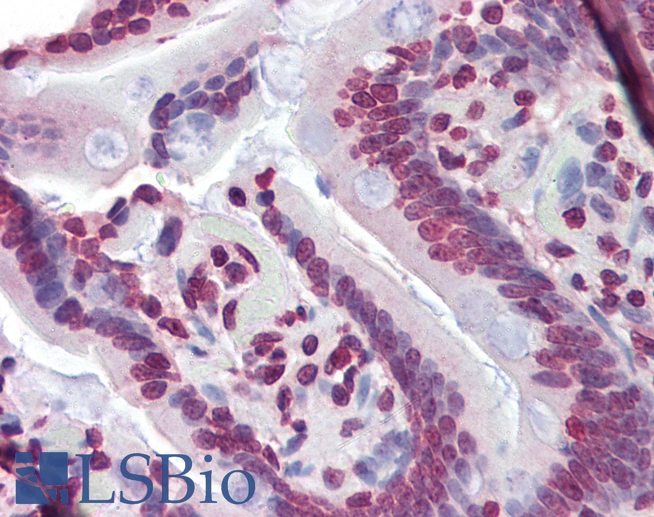 Polyclonal Rabbit anti-Human NR1H3 / LXR Alpha Antibody (C-Terminus, IHC, WB)