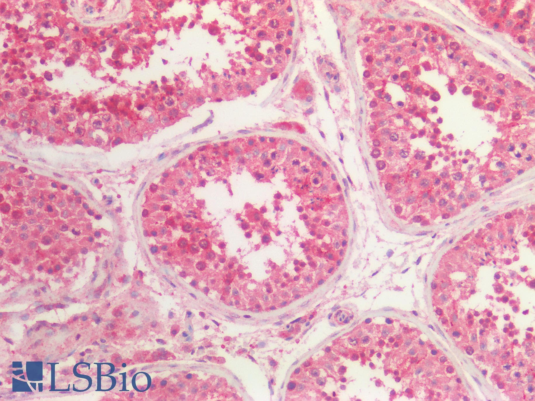 PathPlus™ EPHA4 / EPH Receptor A4 Antibody (Internal)