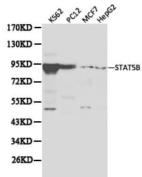 STAT5B Antibody