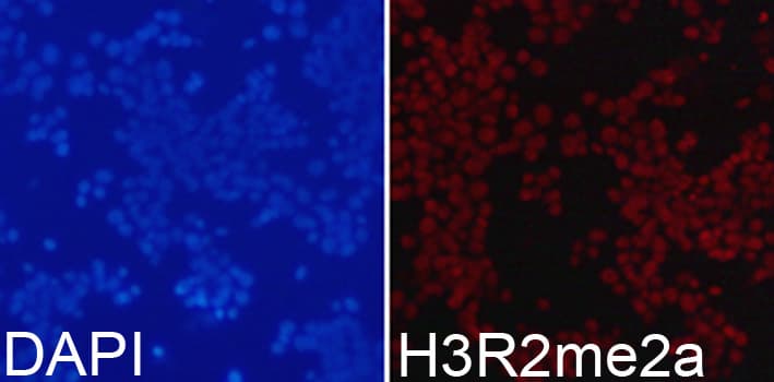 Polyclonal Rabbit anti-Human Histone H3 Antibody (Asym-Di-Methyl-Arg2, IHC, IF, WB)