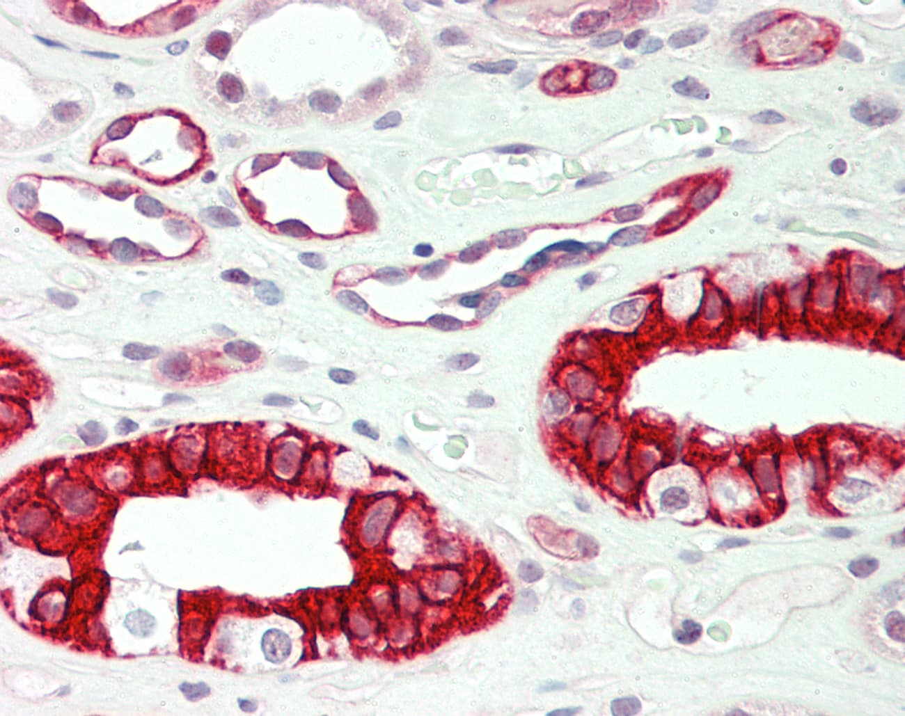 Polyclonal Rabbit anti-Human DPP4 / CD26 Antibody (aa663-712, IHC, WB)