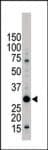 YWHAB / 14-3-3 Beta Antibody (aa217-246)