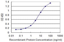 IL4R / CD124 Antibody (aa26-135, clone 1D3)