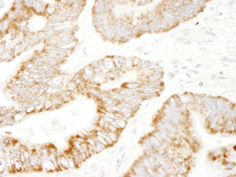 Polyclonal Rabbit anti-Human RAPGEF2 Antibody (aa975-1025, IHC)