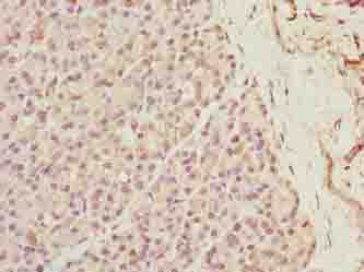 XPR1 Antibody (aa529-696)