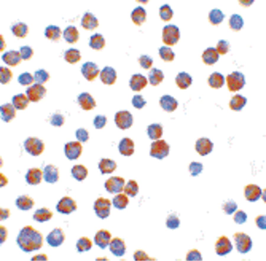 IHC-plus™ Polyclonal Rabbit anti-Human BCL2L11 / BIM Antibody (IHC, IF, WB)