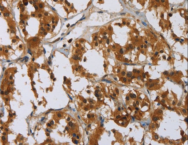 Polyclonal Rabbit anti-Human GATA5 Antibody (IHC)