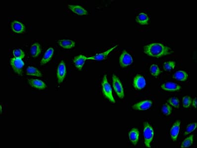 GGT1 / GGT Antibody