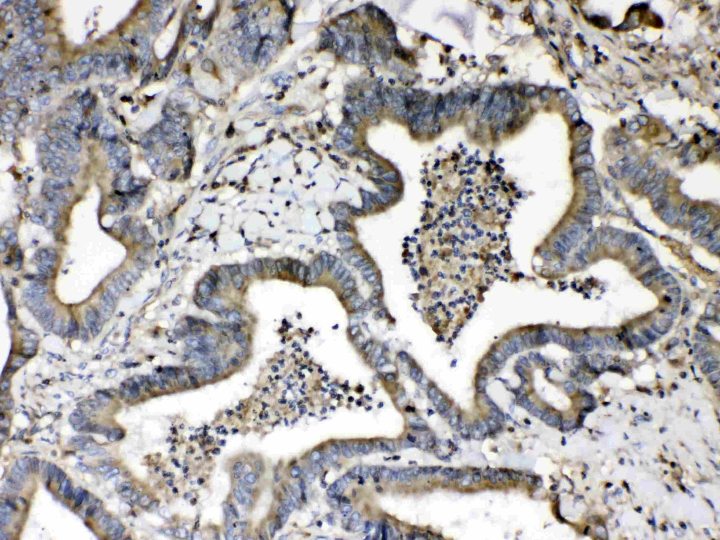 Polyclonal Rabbit anti-Human B2M / Beta 2 Microglobulin Antibody (IHC, WB)